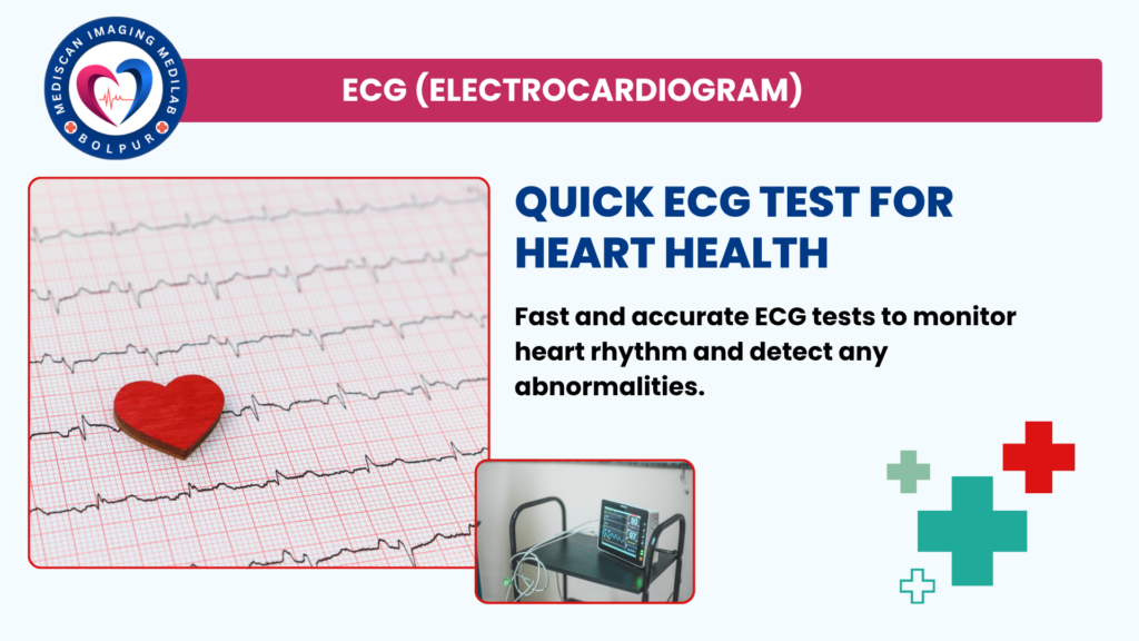 ECG (Electrocardiogram)